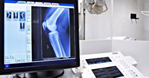 Aplicaciones de la IA a la atención médica