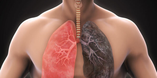Insilico Medicine encontró tratamiento para enfermedades pulmonares en tiempo récord