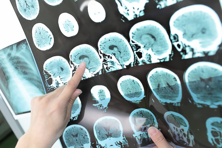 la medicina evoluciona contra el cáncer.