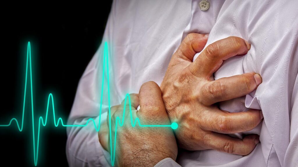 IA tiene alta precisión para diagnosticar ataque cardíaco