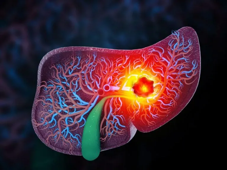 tumor-hepatico